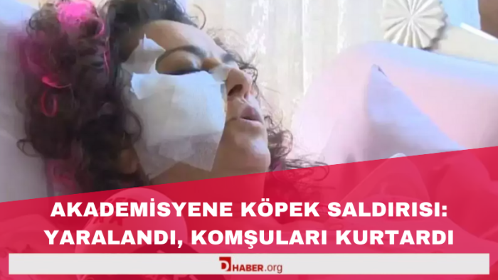 Akademisyene Köpek Saldırısı: Yaralandı, Komşuları Kurtardı